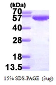 Human GPI protein, His tag. GTX67429-pro