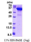 Human Cytokeratin 8 protein, His tag. GTX67512-pro