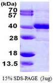 Human MPG protein, His tag. GTX67559-pro