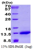 Human NDUFA2 protein, His tag. GTX67580-pro