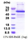 Human PSMD11 protein, His tag. GTX67701-pro