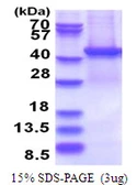 Human PSMD13 protein, His tag. GTX67702-pro