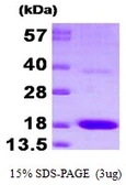 Human PTS protein, His tag. GTX67712-pro