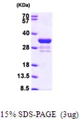 Human Rad1 protein, His tag. GTX67713-pro
