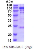 Human PYGL protein, His tag. GTX67717-pro