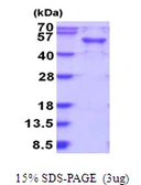 Human RAB3IL1 protein, His tag. GTX67723-pro