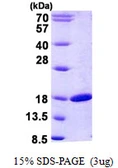 Human RBP2 protein, His tag. GTX67744-pro
