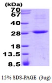 Human RGS16 protein, His tag. GTX67750-pro