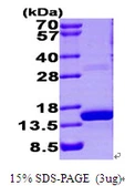 Human S100A9 protein, His tag. GTX67795-pro