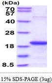Human SKP1 protein. GTX67821-pro