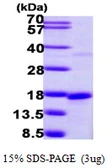 Human SNRPD2 protein, His tag. GTX67840-pro