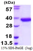 Human SULT1A2 protein, His tag. GTX67861-pro