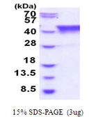 Human TIAL1 protein, His tag. GTX67887-pro