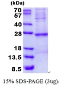 Human Troponin I fast skeletal muscle protein, His tag. GTX67893-pro