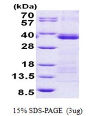 Human U2AF1 protein, His tag. GTX67912-pro