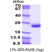 Human UBE2H protein, His tag. GTX67922-pro