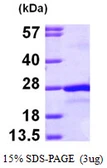Human PTP4A2 protein, His tag. GTX67960-pro
