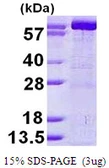 Human GMP synthase protein, His tag. GTX68009-pro