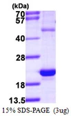 Human HSPB3 protein, His tag. GTX68018-pro