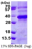 Human Regucalcin protein, His tag. GTX68027-pro