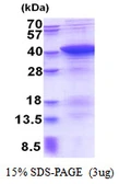 Human PDLIM1 protein, His tag. GTX68029-pro