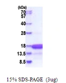 Human HMGN3 protein, His tag. GTX68045-pro