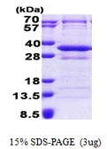 Human CNOT8 protein, His tag. GTX68047-pro