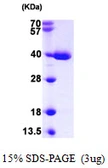 Human TXNL1 protein, His tag. GTX68049-pro