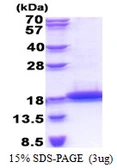 Human TCL1B protein, His tag. GTX68084-pro