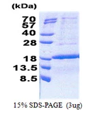 Human KIAA0101 protein, His tag. GTX68089-pro