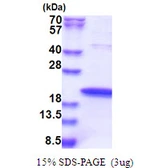 Human ZNHIT1 protein, His tag. GTX68156-pro