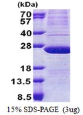 Human ATP5H protein, His tag. GTX68159-pro
