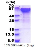 Human DCTN2 protein, His tag. GTX68170-pro
