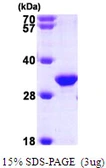 Human TIP30 protein, His tag. GTX68174-pro