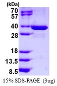 Human SPIN1 protein, His tag. GTX68203-pro