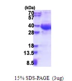 Human EXOSC8 protein, His tag. GTX68251-pro
