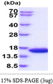 Mouse L-FABP protein, His tag. GTX68262-pro