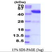 Mouse HPD protein, His tag. GTX68267-pro