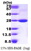 Mouse LYPLA1 protein, His tag. GTX68279-pro
