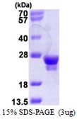 Human RAB18 protein, His tag. GTX68304-pro