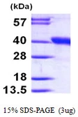 Human DDAH1 protein, His tag. GTX68337-pro