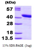 Human HSPBP1 protein, His tag. GTX68343-pro