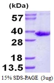 Human SULT1B1 protein, His tag. GTX68408-pro