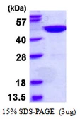 Human GTPBP9 protein, His tag. GTX68444-pro