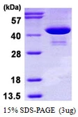 Human PSAT1 protein, His tag. GTX68451-pro