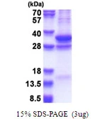 Human COPS7A protein, His tag. GTX68459-pro