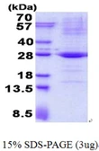 Human TRAPPC4 protein, His tag. GTX68505-pro