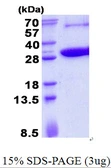 Human KCTD5 protein, His tag. GTX68547-pro