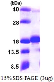 Human UBE2W protein, His tag. GTX68589-pro