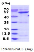 Human GBA3 protein, His tag. GTX68664-pro